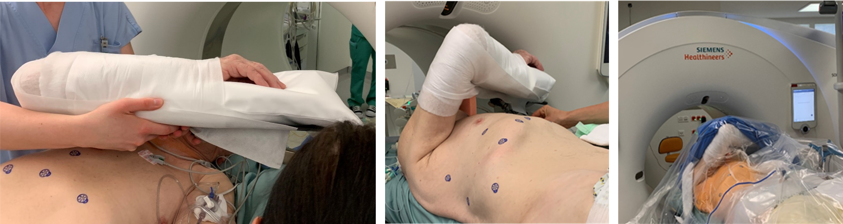 Micromate armrest positioning in liver interventions example