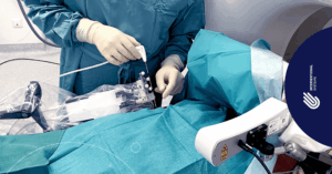 MW ablation of the liver using Micromate robot