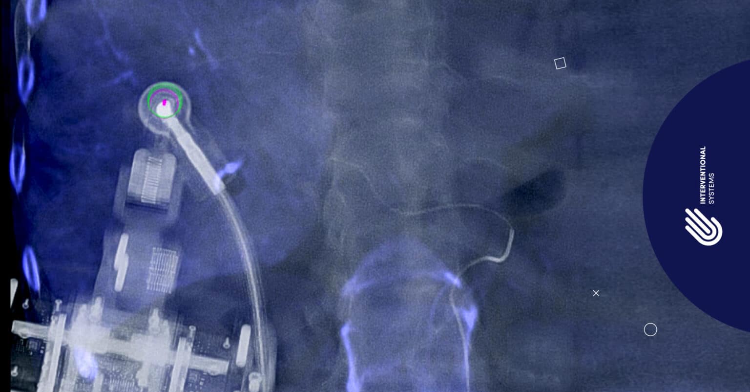 ATEC Spine Launches Valence, a Robotic Navigation System for Spine Surgery